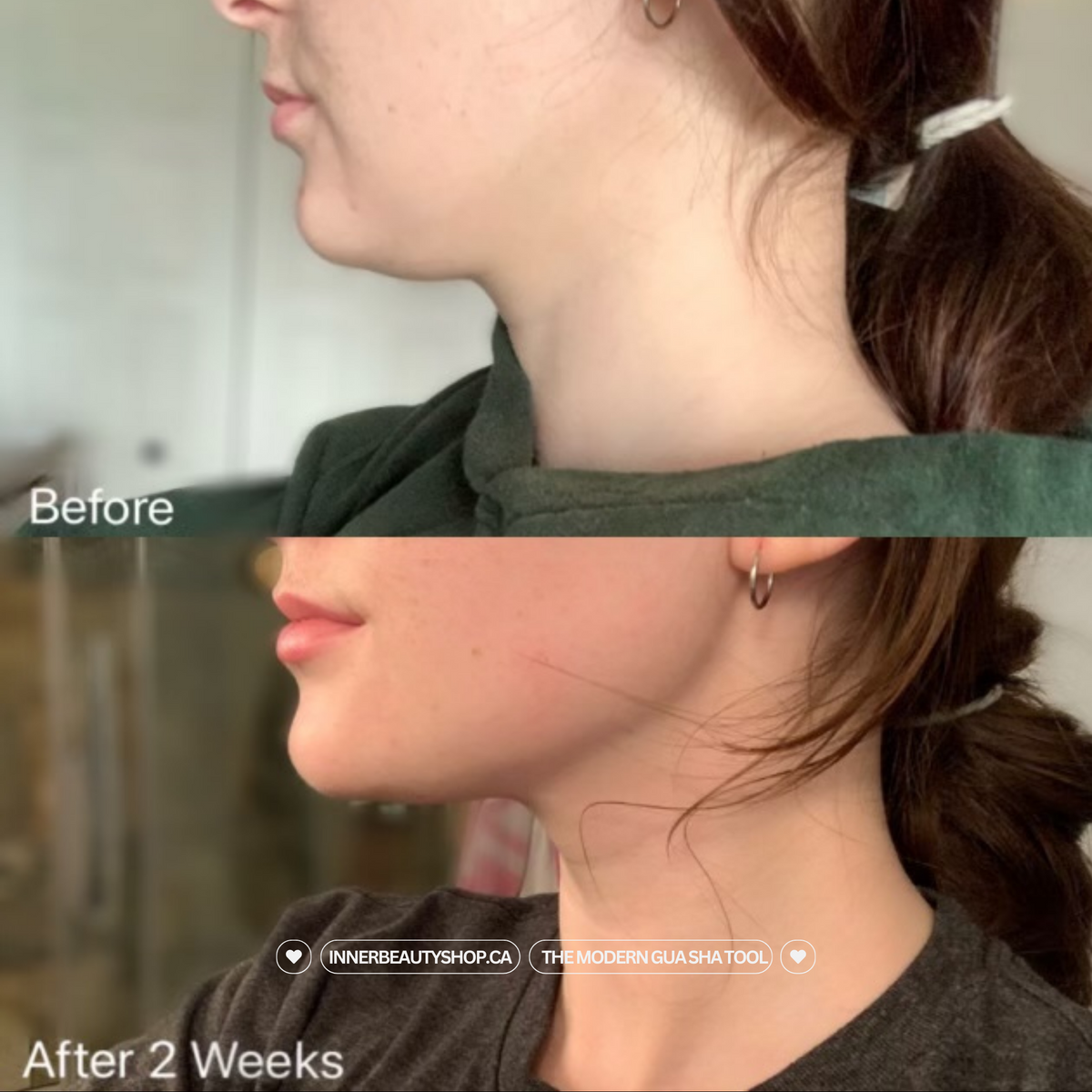 Customer photo: side profile of jaw and neck, before and after two weeks of gua sha
