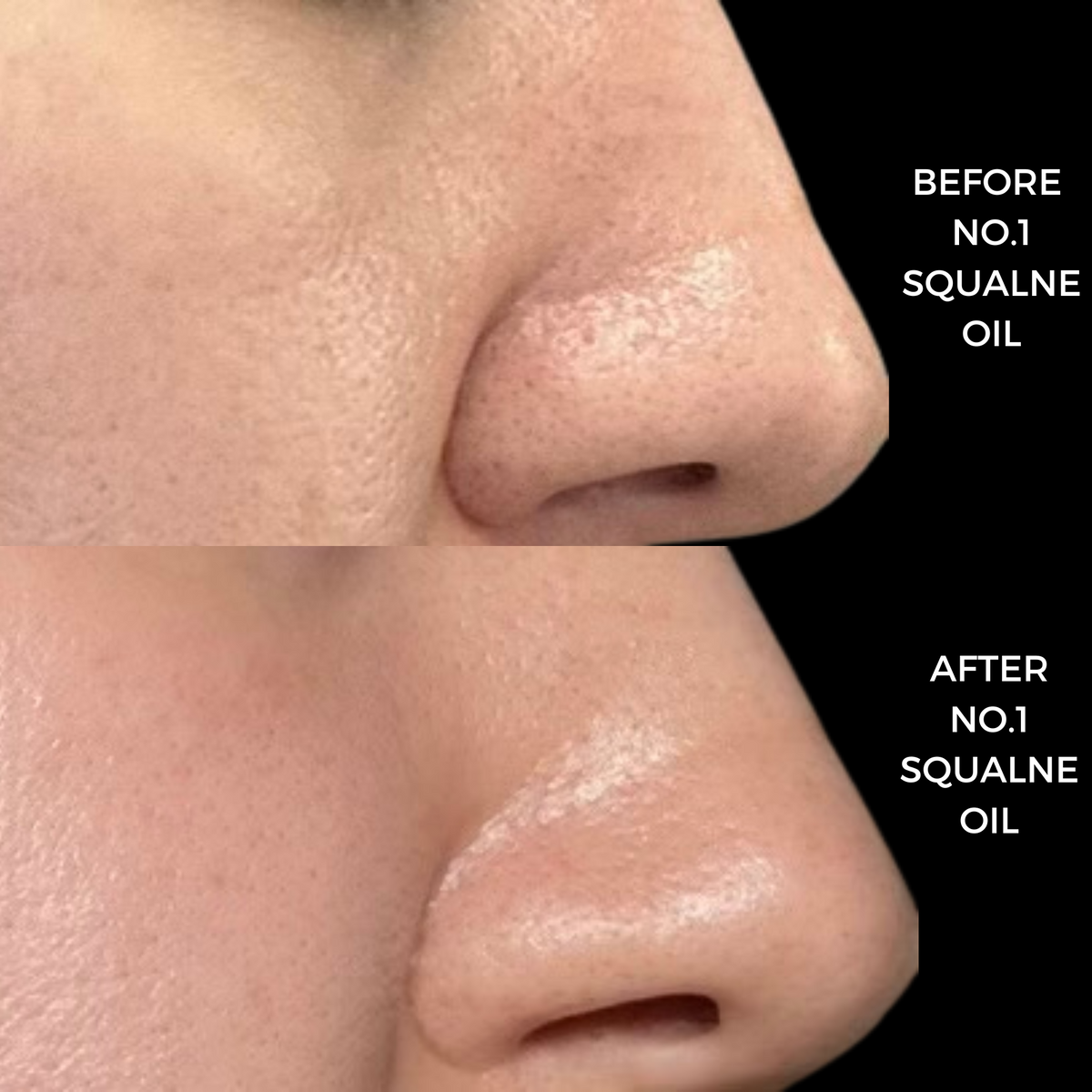 Close-up of skin before and after using N°1 Squalane Oil