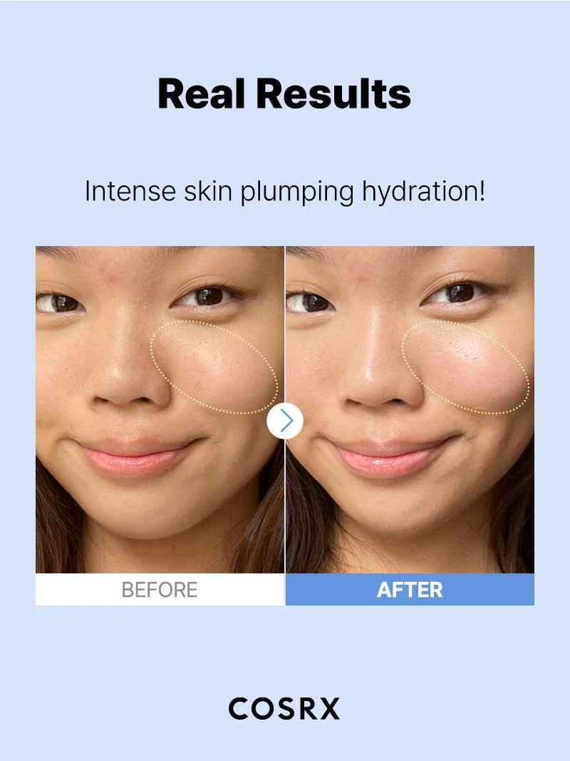 The Hyaluronic Acid 3 Serum by COSRX, view 5