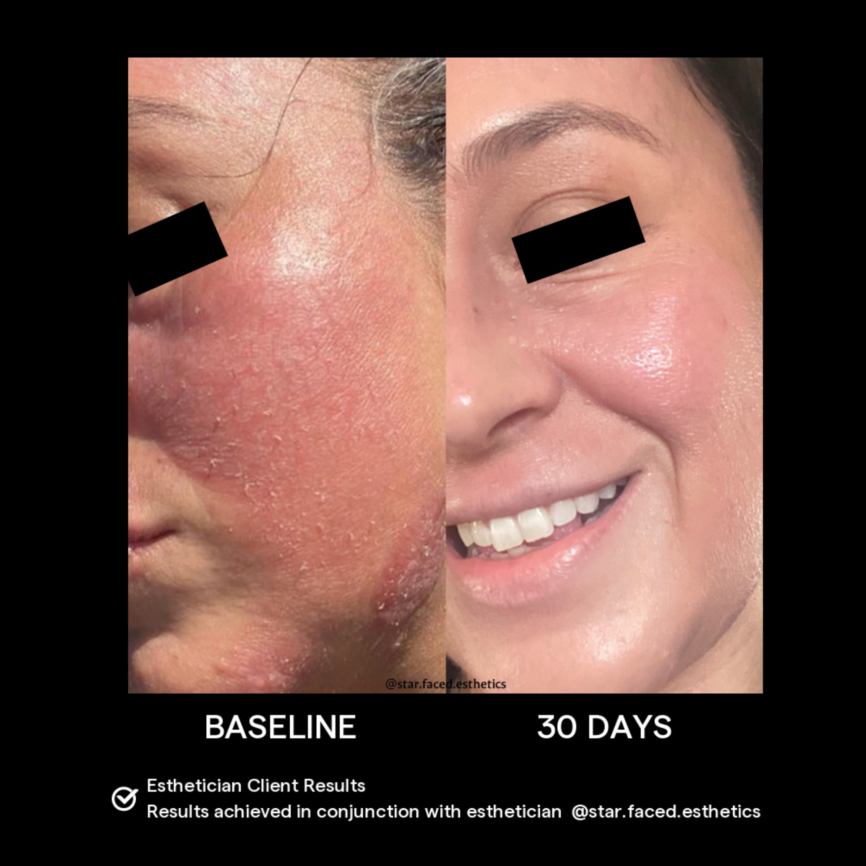 SIV Biome Balancing Serum