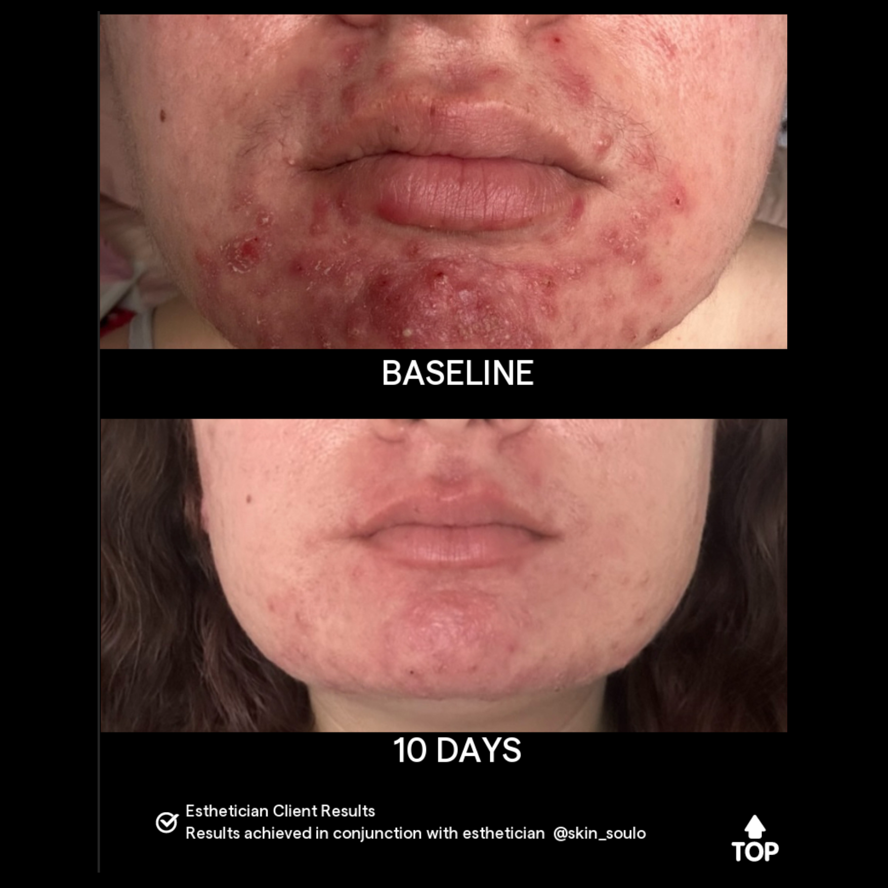 SIV Biome Balancing Serum