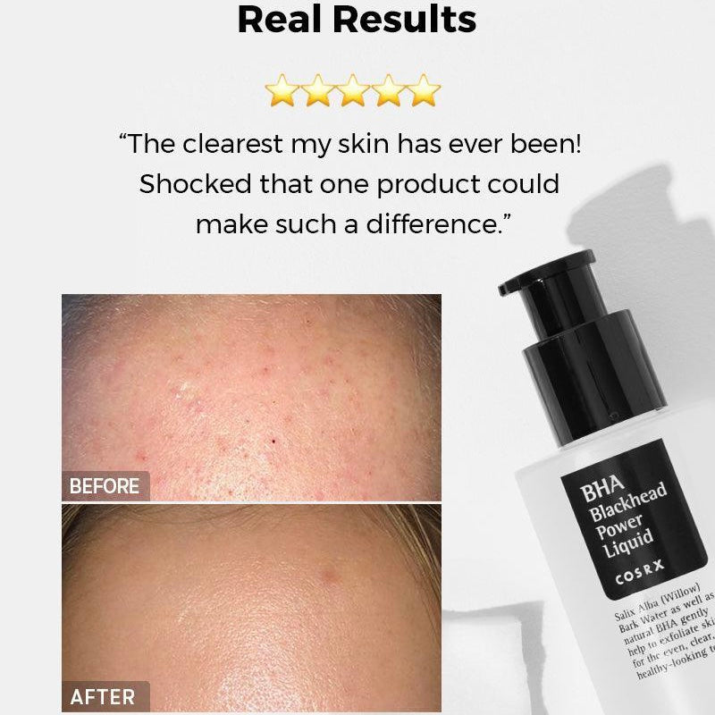 BHA Blackhead Power Liquid by COSRX, view 2