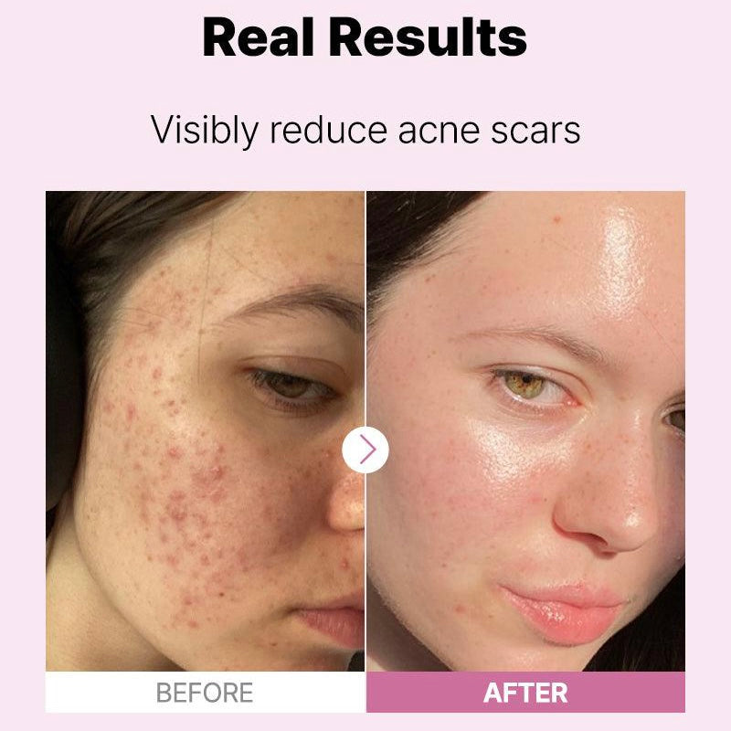 The Niacinamide 15 Serum by COSRX, view 3