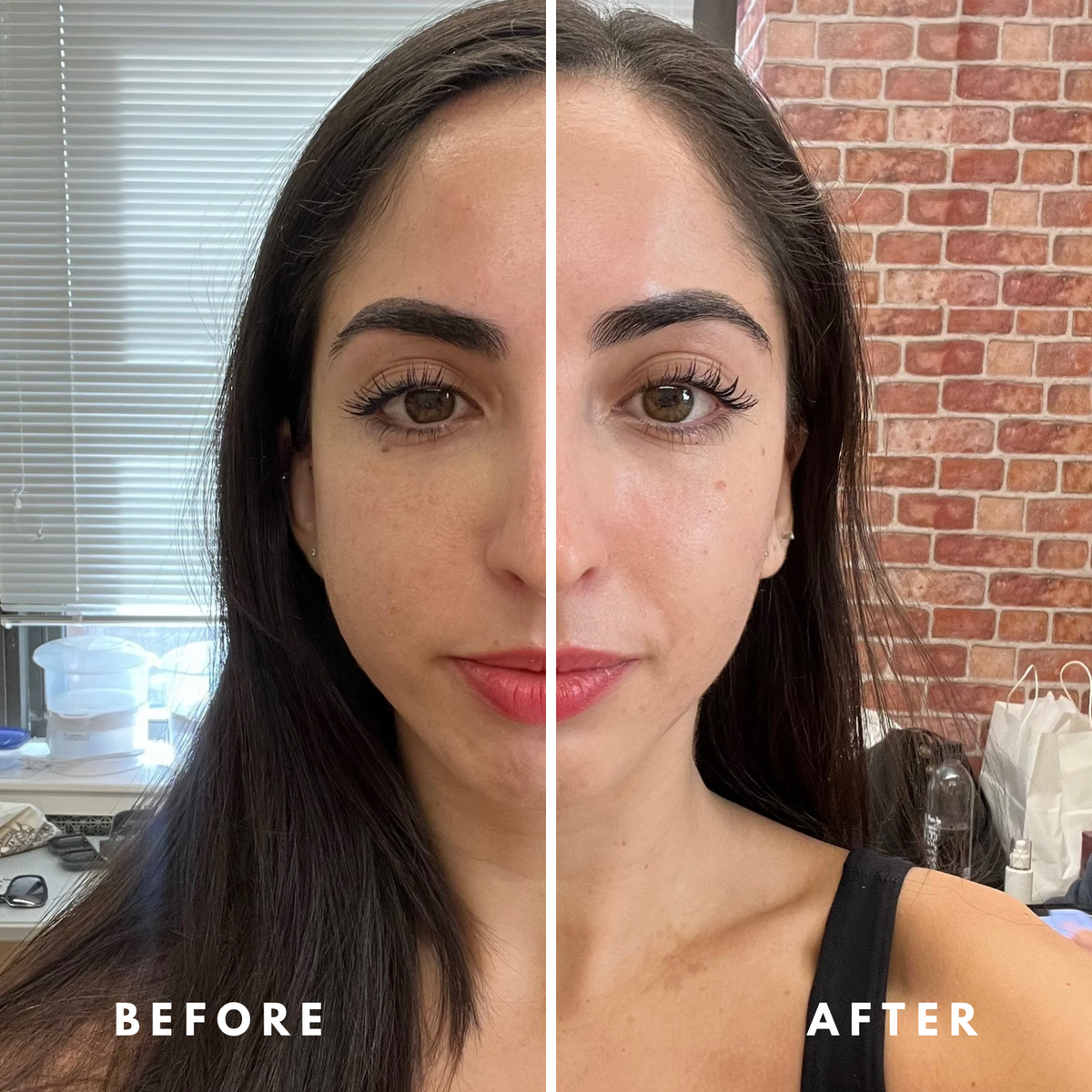 Before and after lymphatic brushing, showing a more defined, refreshed face