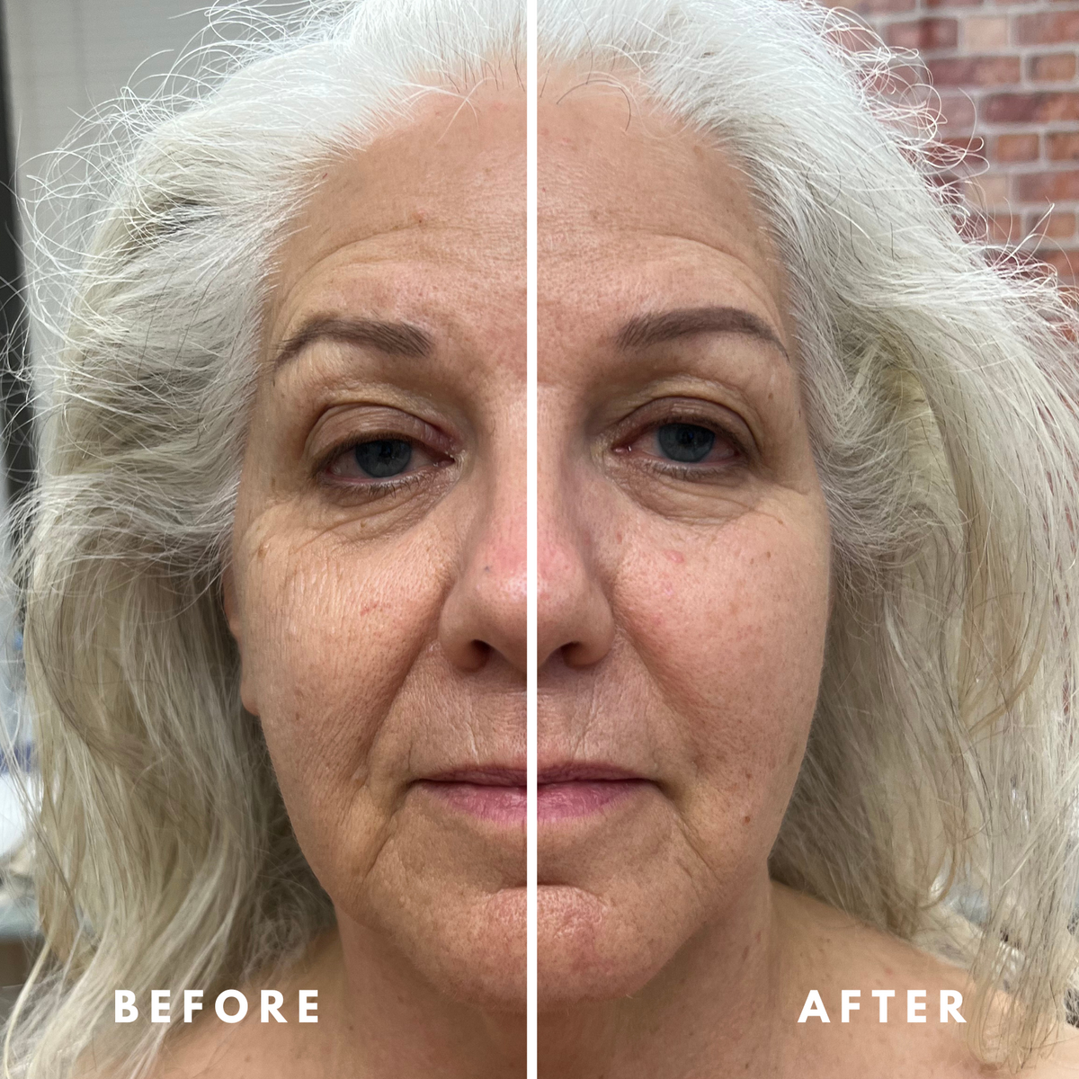 Before and after lymphatic brushing on the face, showing a less puffy, more refreshed look